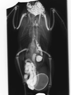 腹壁ヘルニアの消化管造影撮影
